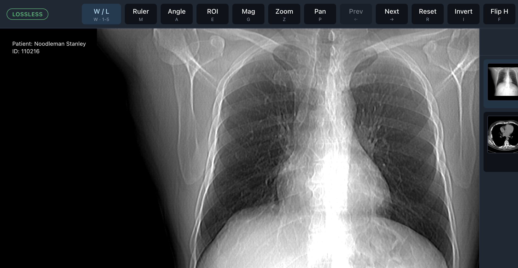 Photon study image review